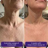 Body Oil for GLP-1 Users